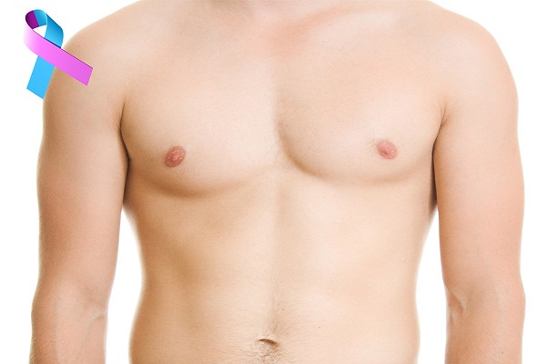 علائم سرطان پستان در مردان