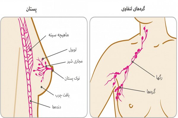 راه‌های درمان سرطان پستان