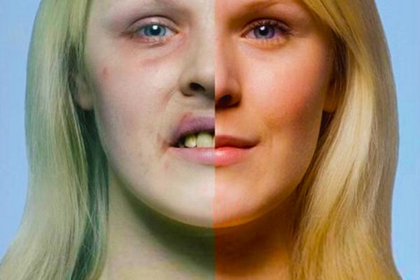 Damage-to-the-skin,-hair-and-nails-from-smoking