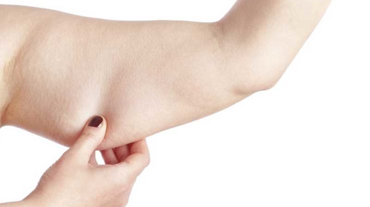 3 ورزش در خانه برای لاغری بازو در زمان کوتاه