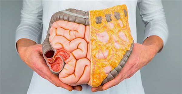 درمان یبوست در دوران رژیم