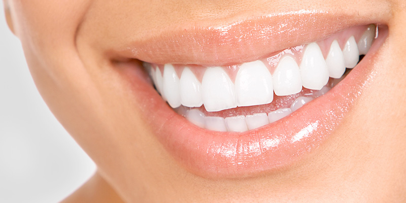 برای مراقبت از دندان های خود در خانه از همین امشب دست به کار شوید