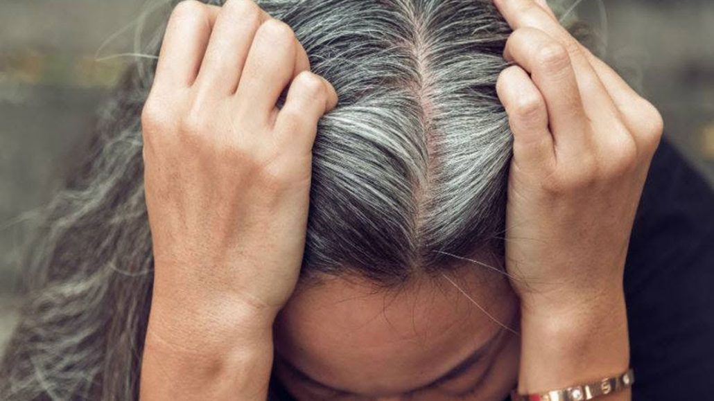 7 روش مؤثر برای درمان سفیدی مو در خانه