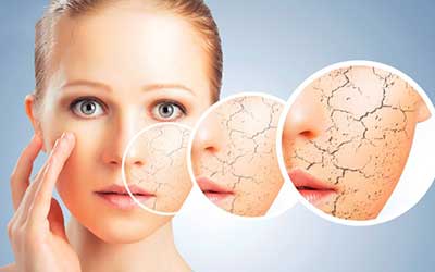 آبرسانی پوست