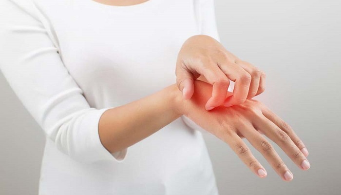 آلرژی به لاتکس