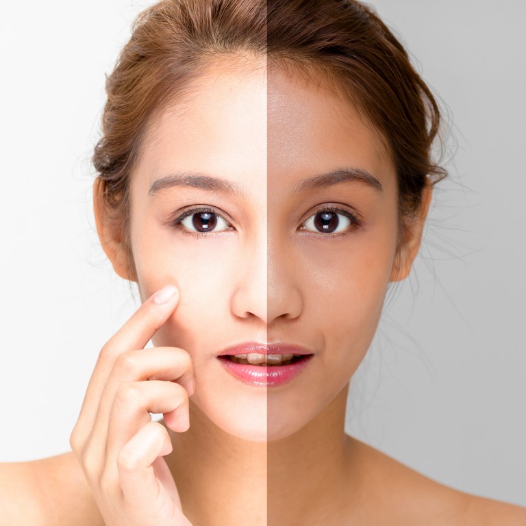 6 راه برای سفید شدن پوست صورت سبزه