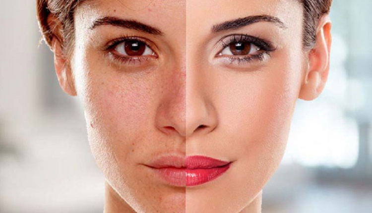 داروی گیاهی برای روشن شدن پوست صورت / دارو برای سفید شدن پوست