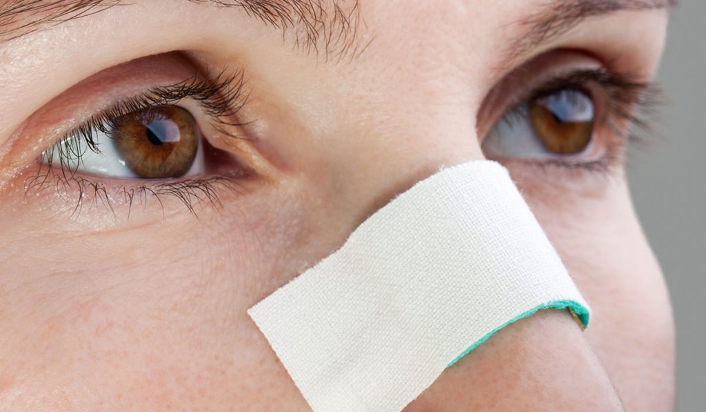 تغذیه بعد از عمل بینی / مراقبت های بعد از عمل بینی