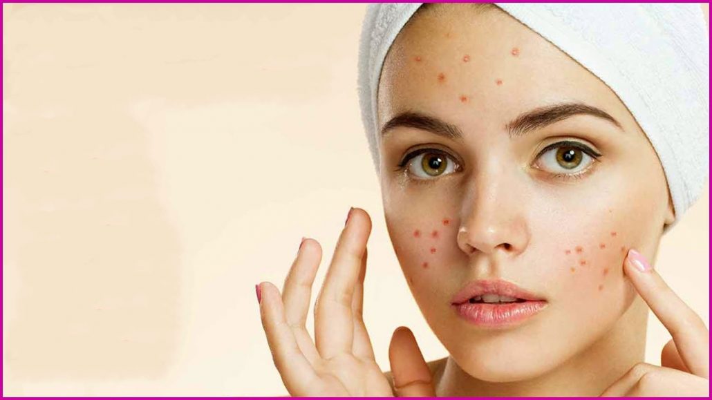 معرفی 7 ماسک لایه بردار خانگی برای پوست چرب