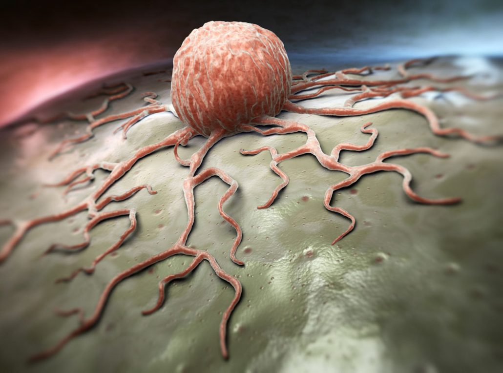 در اینجا ما به لیست غذاهای سرطان زا می‌پردازیم.