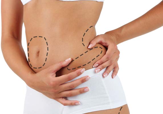 برای جلوگیری از افتادگی پوست هنگام لاغر شدن نیز اقدام کرد.