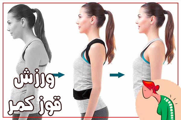 Treat lumbar hump with exercise at home