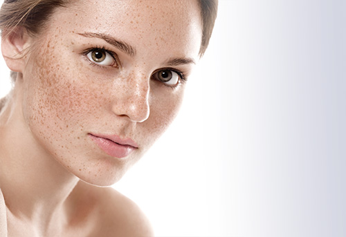 سریع ترین راه از بین بردن لک صورت ارثی در خانه