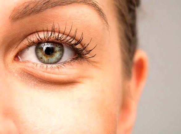 علت پف زیر چشم چیست | درمان قطعی پف زیر چشم در خانه