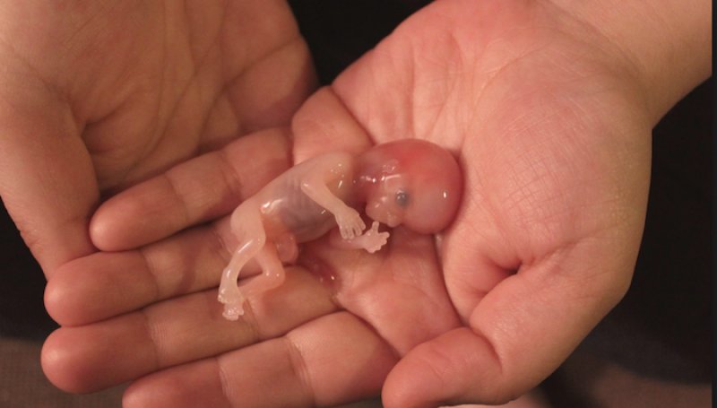 مراقبت های بعد از سقط جنین در طب سنتی