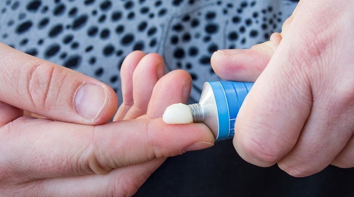 هموروئید نام دیگری بیماری بواسیر است 