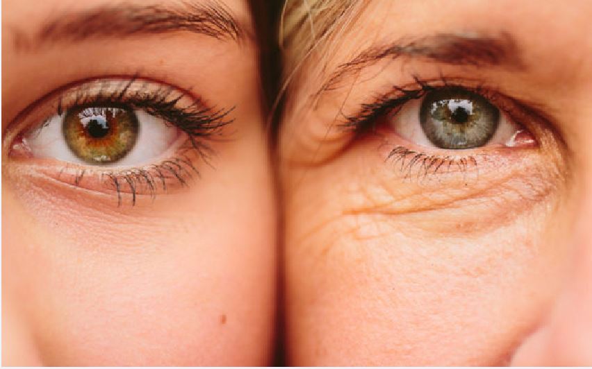 علت افتادگی پلک بالا و راه‌های درمان آن