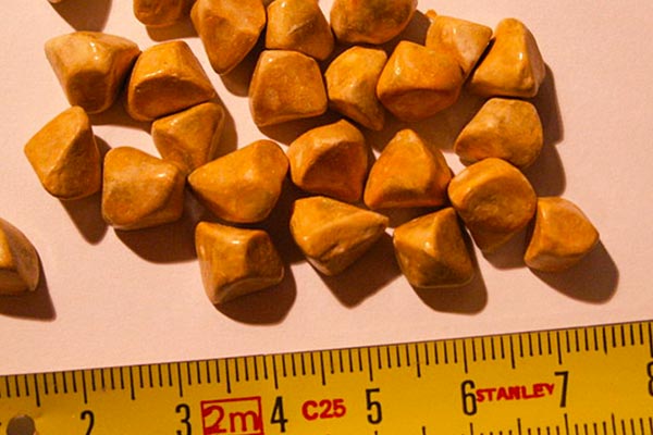 عمل کیسه صفرا