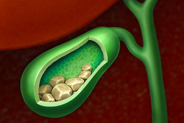 کیسه صفرا و بیماریهای آن