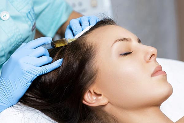 مزوتراپی موی سر چیست