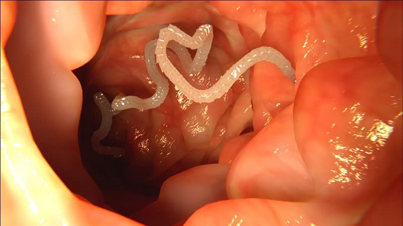 علائم انگلها در بزرگسالان