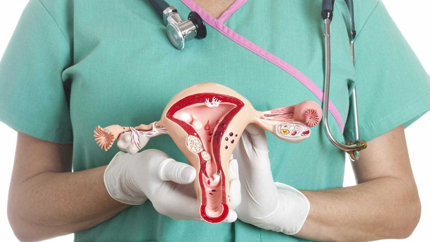 درمان فیبروم رحم با رازیانه