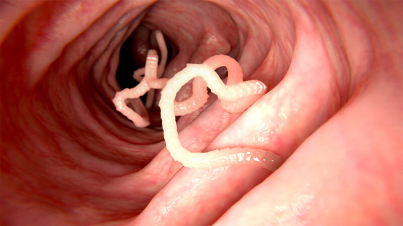 درمان انگلها در بزرگسالان