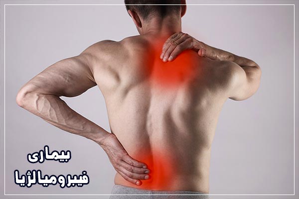 بیماری فیبرومیالژیا چه علائمی دارد