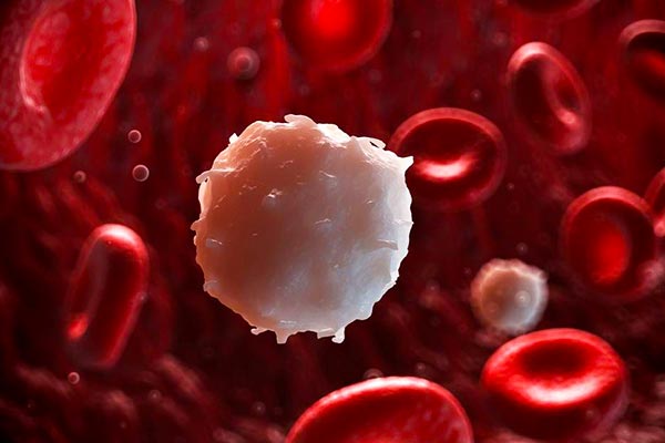 علائم بیماری لوسمی چگونه است