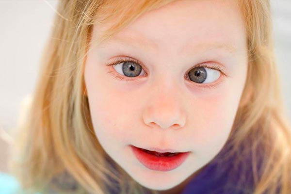 عمل انحراف چشم چقدر طول میکشد