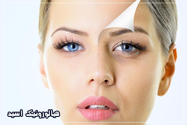 هیالورونیک اسید برای پوست
